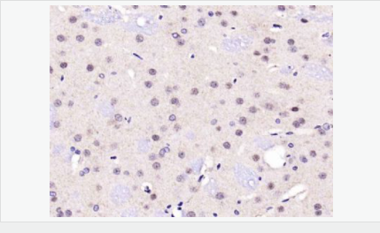 605437bc4e4fb.png image.png